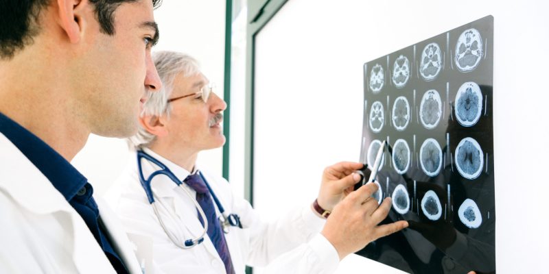 Doctors consult over an MRI scan of the brain.